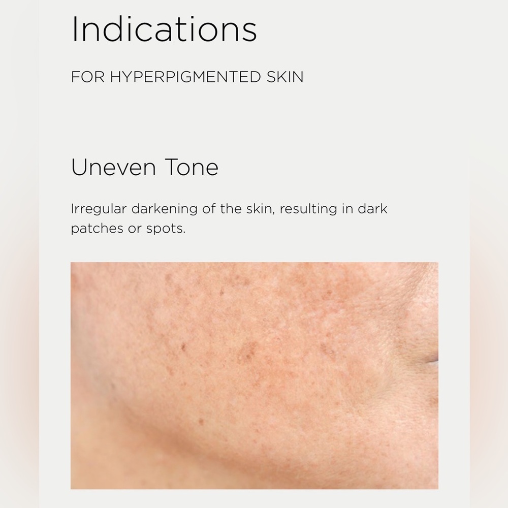 Enhance Brightening Serum - - Picture 3 of 12